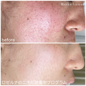 いつも光の強さでどんな風に自分の肌が見えているのか気になっていました