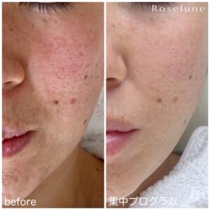 今始めたら、10月頃の肌はこんな風に変わっています