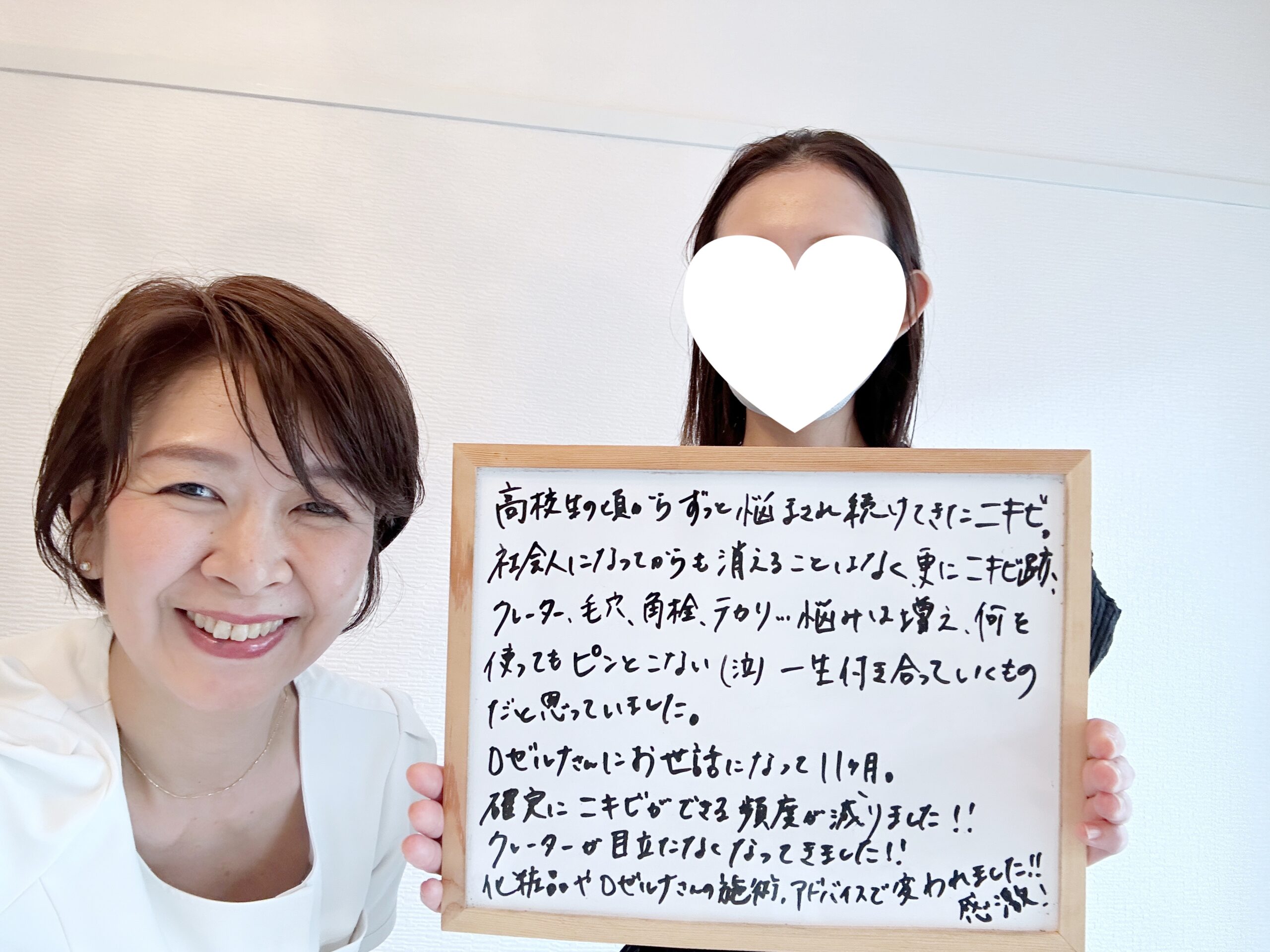 サロンに通うまでは、ニキビとクレーターは一生付き合っていくものだと思っていた